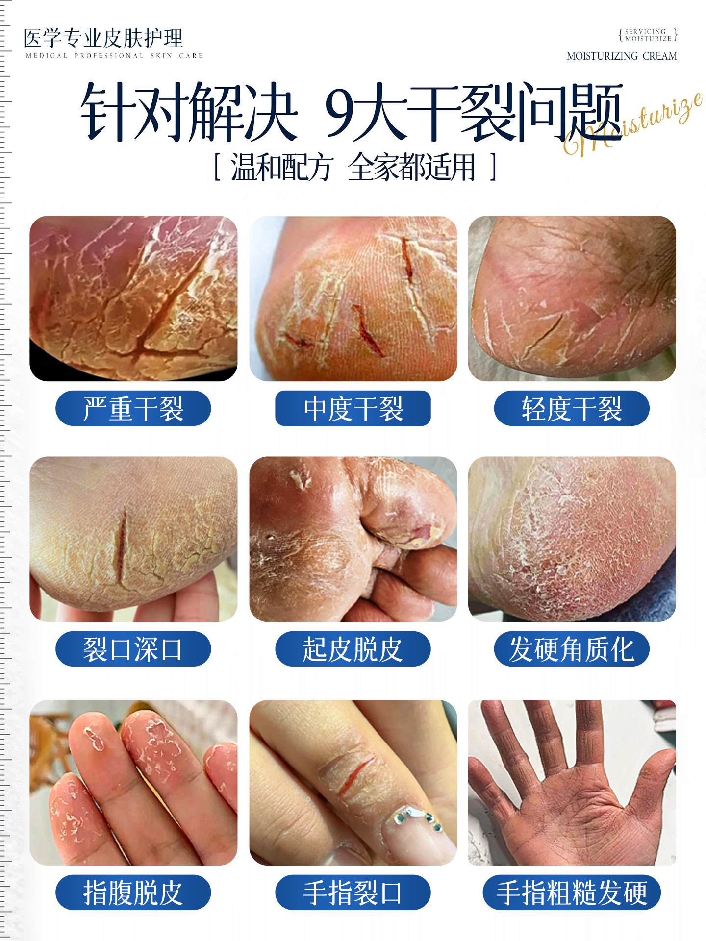 Heel Crack Repair Cream for Hard Skin, Cracked Heels, and Cracked Fingers, Imported Moisturizing Hand Cream