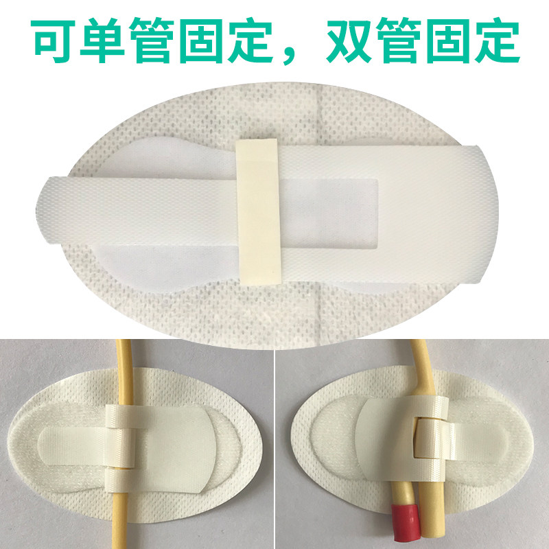 导管固定贴透气防水引流导尿管体表导管固定装置绑带敷料1片