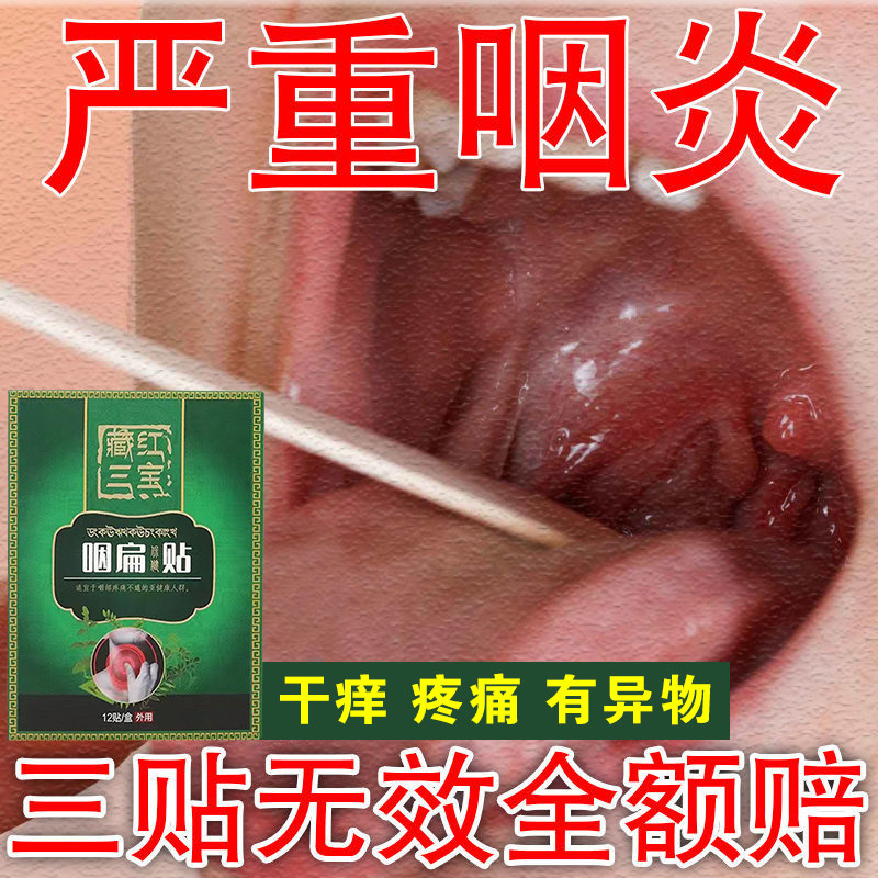 Pharyngeal sticking sticky vocal cord summary