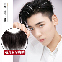 Intertextug Wig Post Invisible Forehead men Tonic Hair sheet All True Fat Man Air Liu Hai-M Type fake Liu Hai
