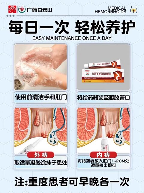 Hemorrhoid Ointment Genuine Product for Eliminating Hemorrhoids and Healing Anal Fissures for Women, Carbomer Gel Flagship Store Official