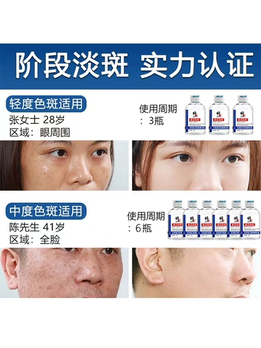 修正 Осветляющая сыворотка, меланин, эссенция для лица, удаление веснушек