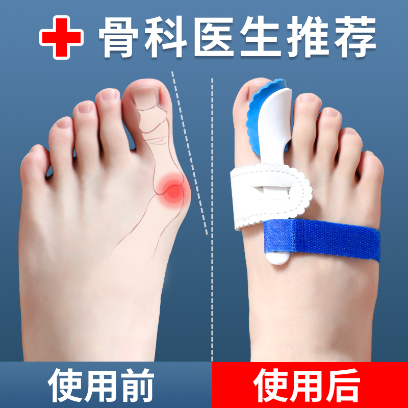Hallux Valgus Improvement Tool Hangover Footter Valgus Feet Mother-son Valgus Orthotic Straightener Large Toe Toe Splitter