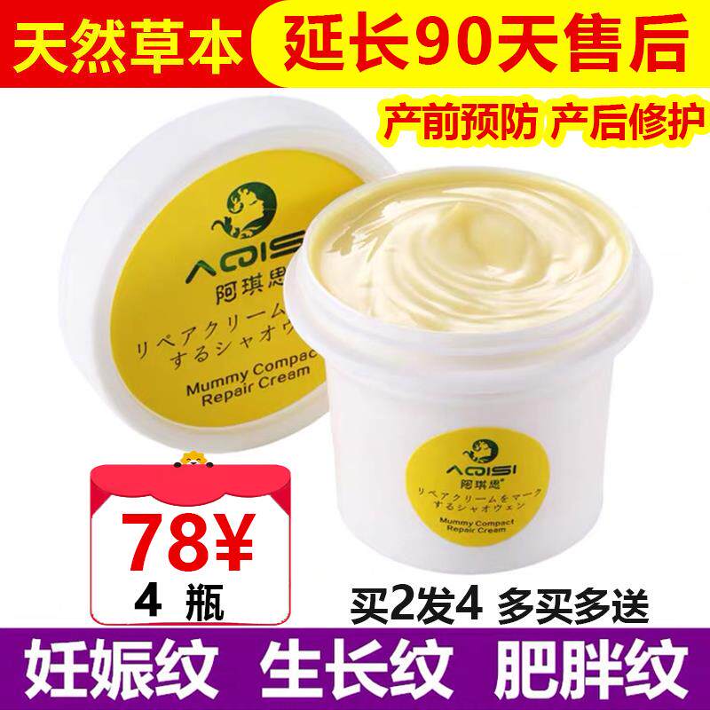 Pregnant women's special stretch marks removal repair cream postpartum elimination to remove compact and dilute obesity lines prenatal prevention of Renchen lines