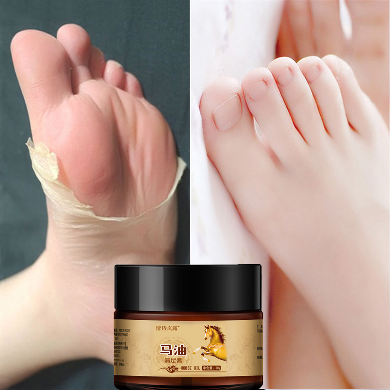 Special Offer (Footer's Gram Stars Farewell to Cracked) Hands And Feet Dry Crack A Recovery Buy 1 1 2 Buy 3 2