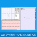 San Rui Xin Electric Private Work Statation Информационная система управления информацией автоматический анализ детектор результатов его соединения