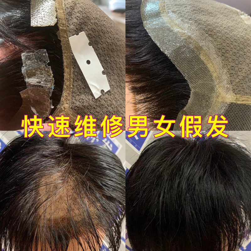 Wig Repair, Replacement of Broken Mesh Base, Replacement of Headband, Biological Membrane, Men's and Women's Hairpieces