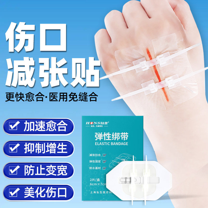 减张器皮肤伤口医用疤痕愈合手术剖腹产儿童术后拉链伤口贴减张贴