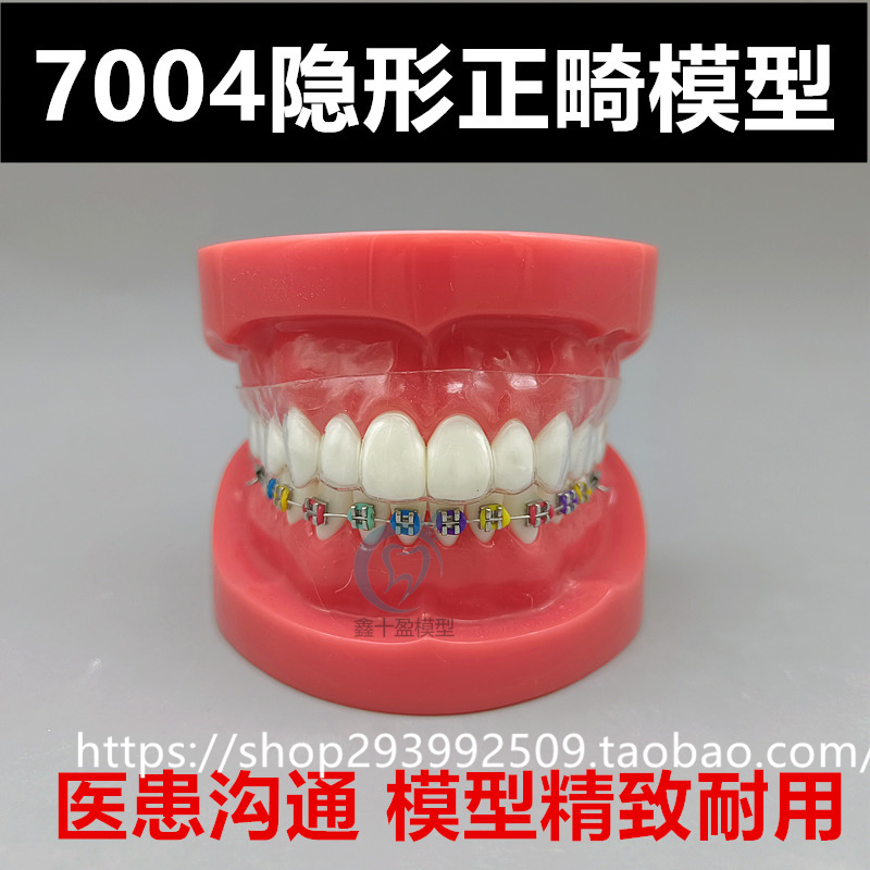 牙科口腔教学模型 隐形正畸矫正模型 金属正畸模型 口腔展示模型