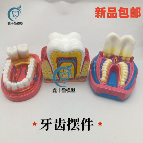 牙科口腔摆件 牙齿摆件 趣味牙齿摆台 口腔诊所礼品口腔牙齿模型
