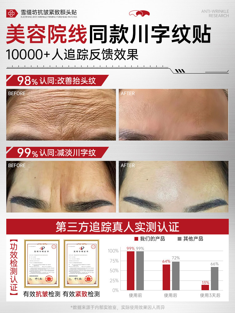 Forehead Wrinkle Removal Tool, Forehead Lifting and Tightening, Sleep Wrinkles, for Men and Women, Official Flagship Store