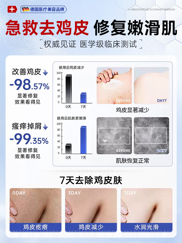 Fruit Acid Body Lotion to Remove Skin Pimples, Moisturize and Nourish Women's Dry Skin, Relieve Itching, Hydrating and Moisturizing Lotion for Men in Autumn and Winter