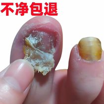 (Watsons best seller) Remove 99% of gray potassium fungus with one drop no guarantee or repair no guarantee of return if invalid