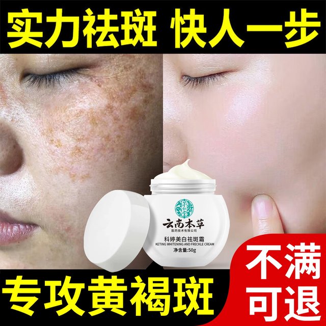 Remove Spots, Remove Chloasma and Freckles, Official Genuine Product for Removing Age Spots, Special Whitening and Lightening of Color Spots, Whitening and Freckle Removal Cream