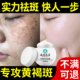 Remove Spots, Remove Chloasma and Freckles, Official Genuine Product for Removing Age Spots, Special Whitening and Lightening of Color Spots, Whitening and Freckle Removal Cream