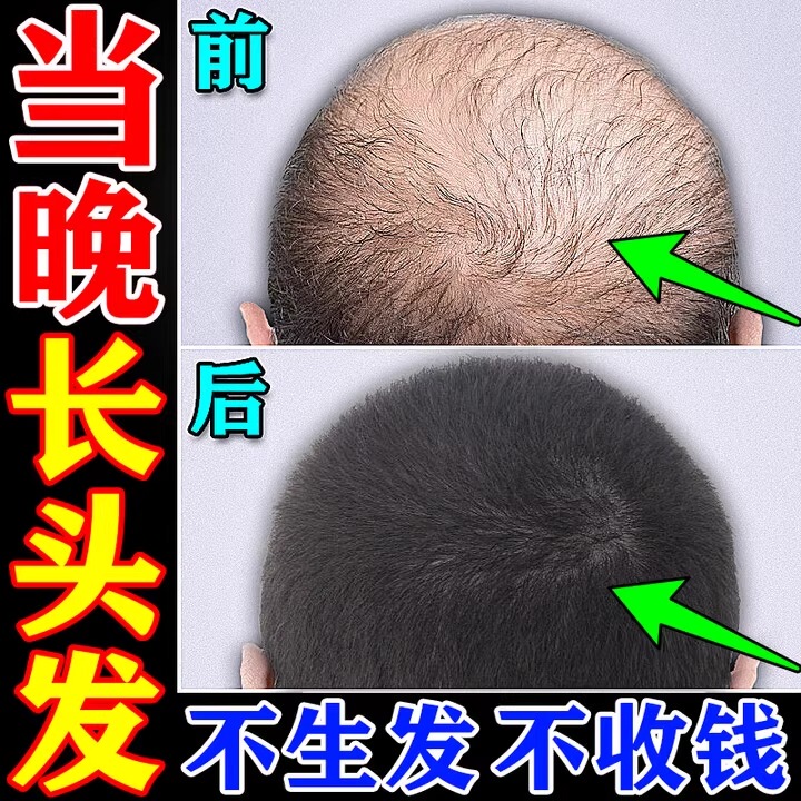 Hair Growth Agent for Rapid Growth and Hair Thickening, Anti-Hair Loss Solution, Specialized Hair Growth Serum for Men and Women, Hair Thickening Essence, Hair Growth Miracle Product