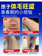 ຄີມກໍາຈັດຂົນໄວຫນຸ່ມສໍາລັບນັກຮຽນ, ປາກຂອງເດັກນ້ອຍ, ການກໍາຈັດຮາກຖາວອນຂອງຜົມປາກແລະ mustache, ປອມສໍາລັບເດັກຊາຍແລະເດັກຍິງ