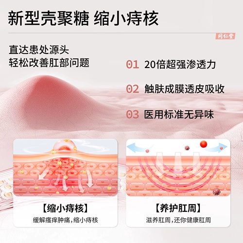 Крем от геморроя, режущий корень геморроя, натуральная мазь с фрикадельками, гель со специальным эффектом для беременных Официальный флагманский магазин для женщин