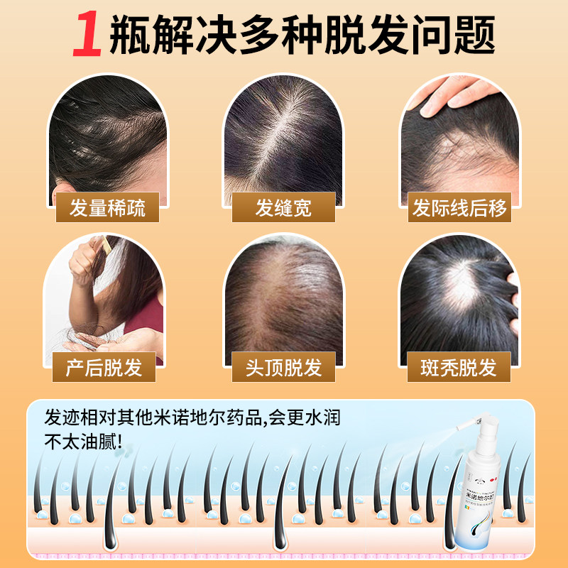 发迹米诺地尔酊5% - 男女通用，告别斑秃，重获新生！