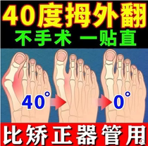 (Valgus Permale-me Total Escort) Thumb Valgus Large Footed Bone Deformity Valgus Correction Toe Overlap Special Paste Patch
