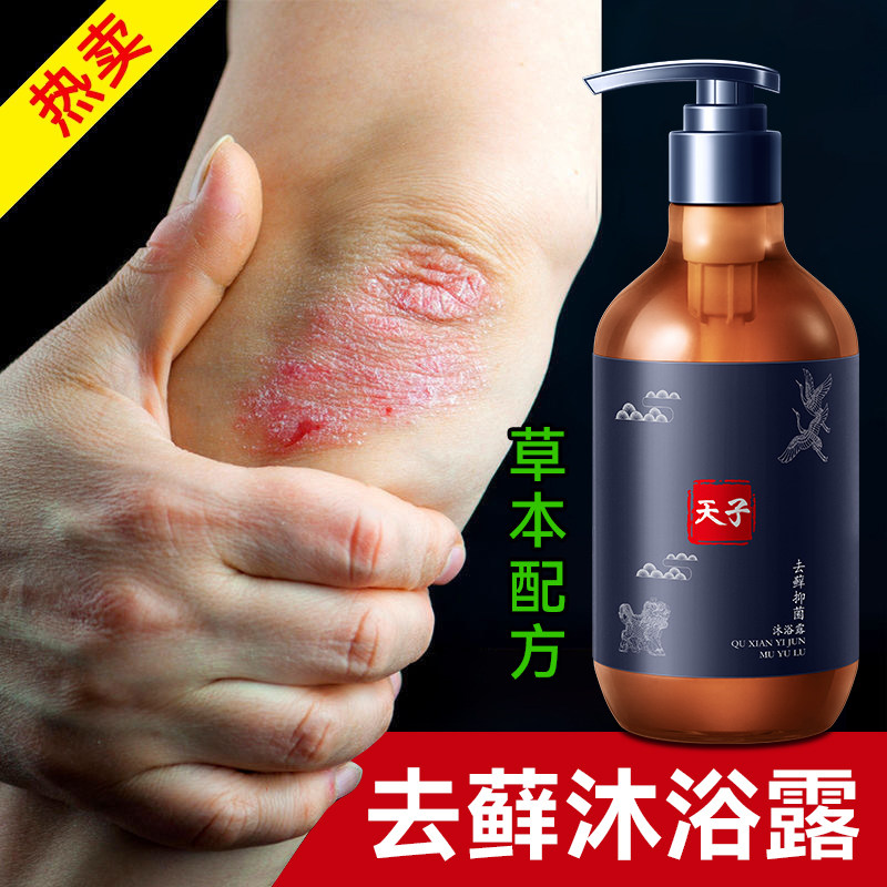 Dai Shihan to remove mites, acne, body skin, itching, itching, antibacterial, hand and foot moss, psoriasis, psoriasis, shower gel