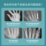 Перелом перелома запястья уход за запястьем фиксация ветви Пятая пальмовая кость