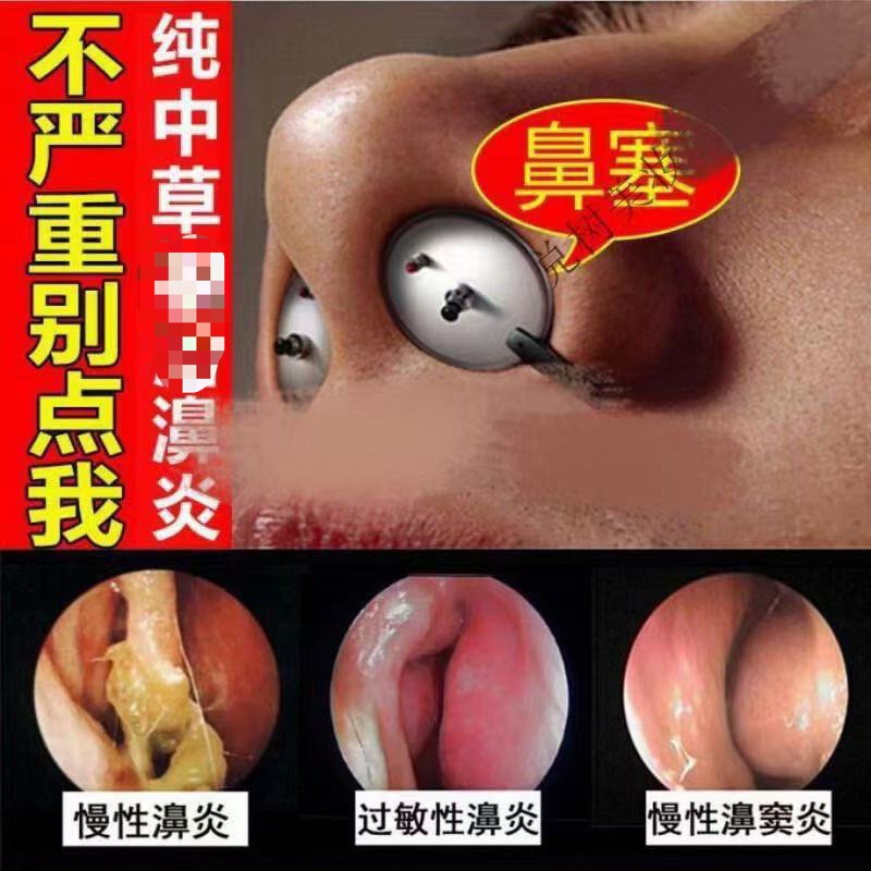 Cream for Children with Allergic Sinusitis, Nasal Congestion, Nasal Polyps, and Nasal Congestion Relief Cream for Children with Allergic Sinusitis, Nasal Congestion, Nasal Polyps, and Nasal Congestion Relief