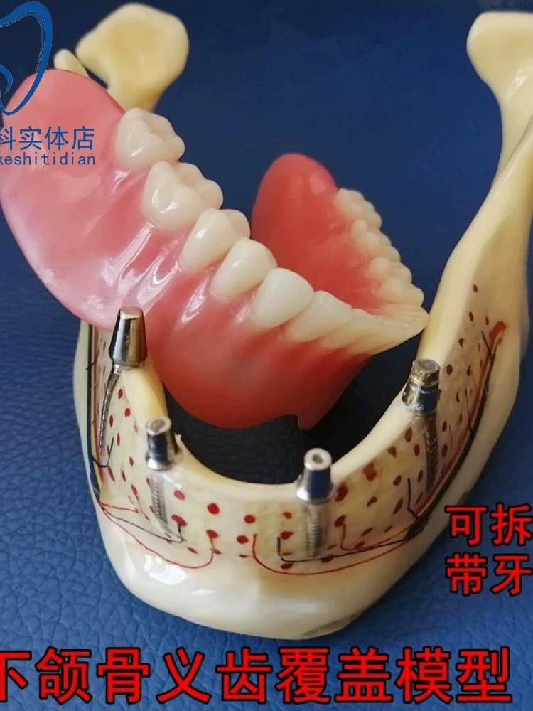 透明下颌骨模型｜让复杂的牙科知识变得“触手可及”_口腔护理设备礼盒_
