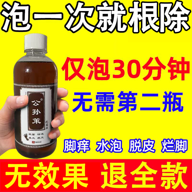 Athlete's Foot Anti-Itching, Peeling, and Antibacterial Solution for Relieving Foot Itching, Blisters, and Dry Cracked Toe Seams; Special Foot Soak for Fungal Infection Treatment Athlete's Foot Anti-Itching, Peeling, and Antibacterial Solution for Relieving Foot Itching, Blisters, and Dry Cracked Toe Seams; Special Foot Soak for Fungal Infection Treatment