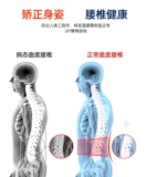 Поясничная поясничная поясничная поясничная талия, поясничные мышцы, женщины, получившие повреждение живота, живота, окружности талии, талии, талии медицинской боли в спине Специальные