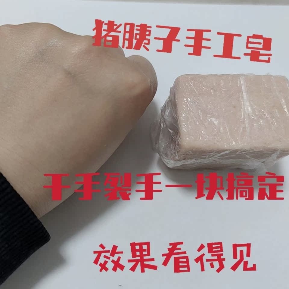 Pig pancreas dry hands, cracked hands, chapped skin, don't be afraid of one piece to solve your troubles