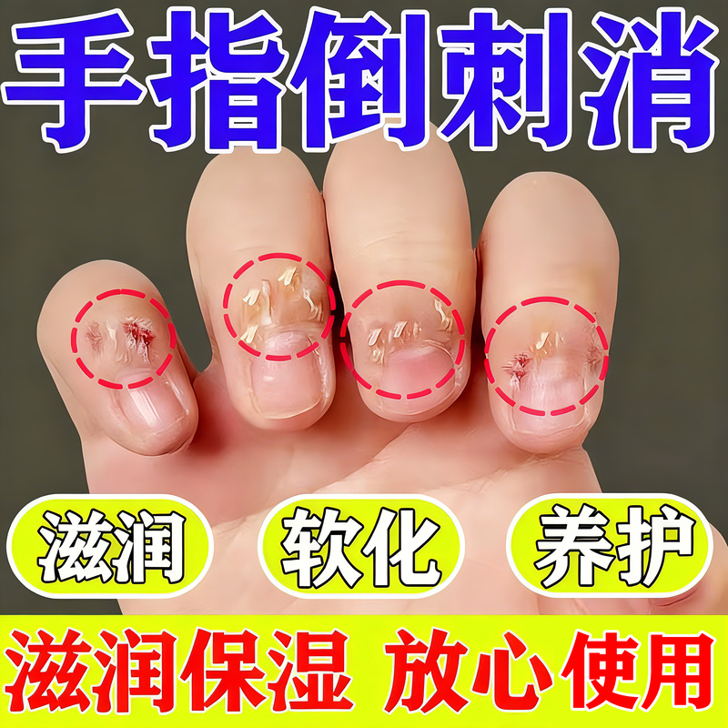 Nutritional Oil for Finger Hangnails, Children's Repair Care, Anti-Hangnail Hand Cream for Cracked and Peeling Nail Edges