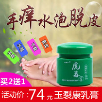 Jade Kang cream blisters skin disease Special sweat spore eczema small blisters on the hands