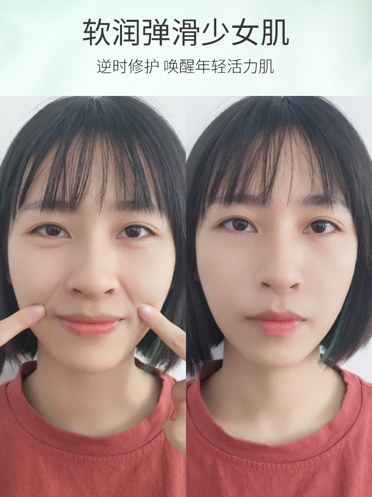 (Recommended by Li Jiaqi)Dilute nasolabial folds artifact Nasolabial folds small iron Farewell Nasolabial folds Buy 2 get 1 free