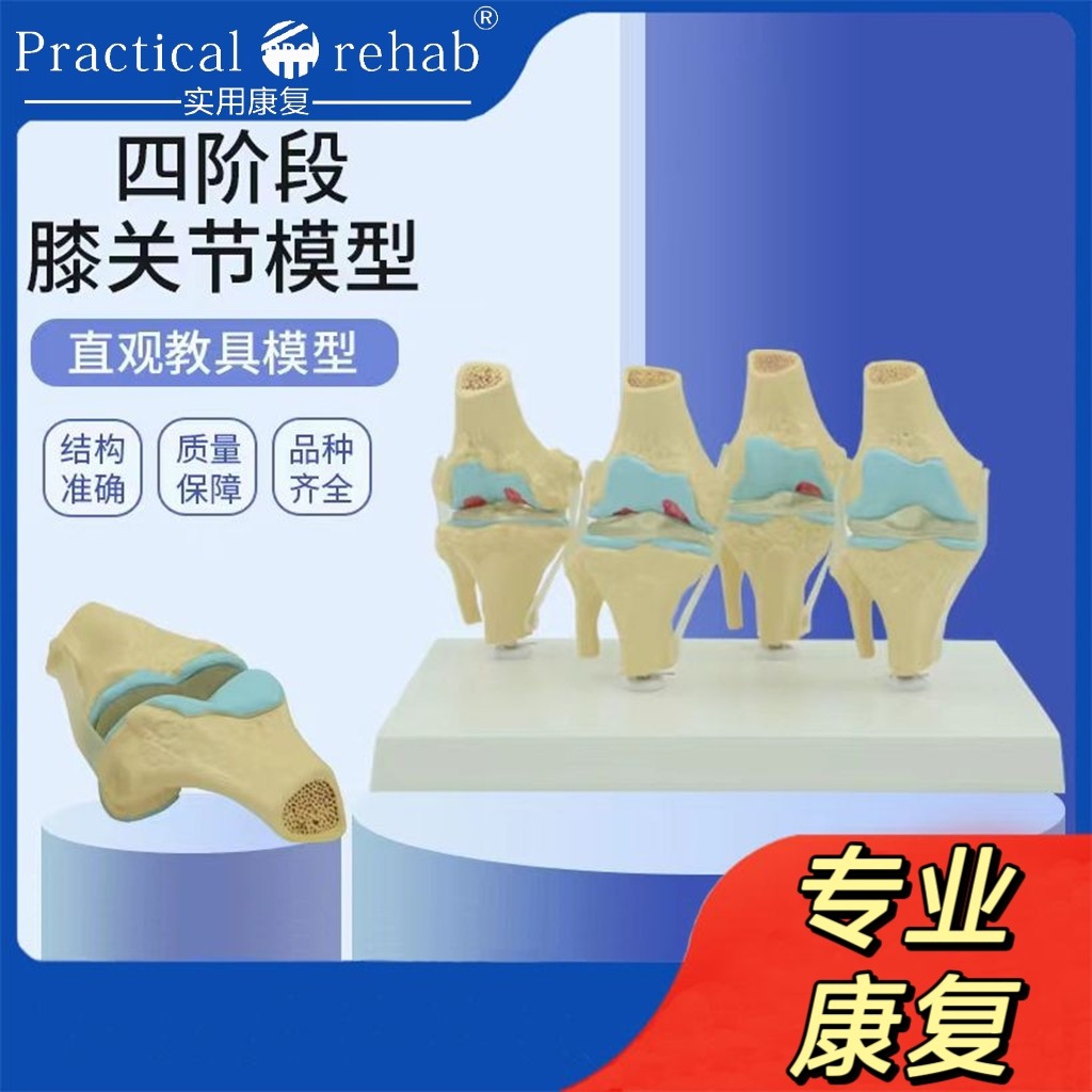 人体膝关节模型 正常与病理对比教具 医药礼品医患沟通道具正品