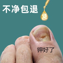 (Tongrentang hot sale) Replace potassium painlessly in 7 days enjoy a good nail life and turn bad nails into good ones with one drop of S3