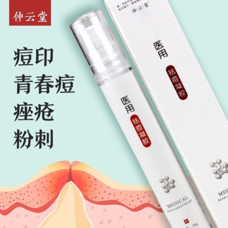 Zhongyun Tangduo acne-removing and oil-controlling artifact acne-removal and oil control