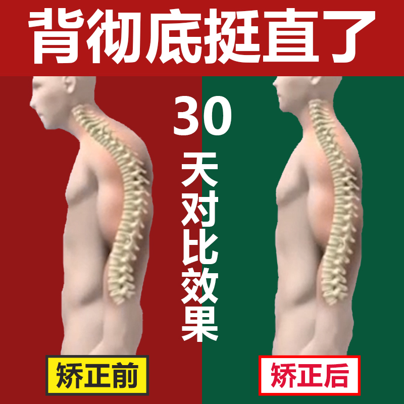 Improve humpback corrector Correct back Female custom program Male summer children with correction round shoulder straight back artifact