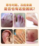 Антибактериальное детское молочко для тела для ступней для лица для ухода за кожей, крем, 20 грамм