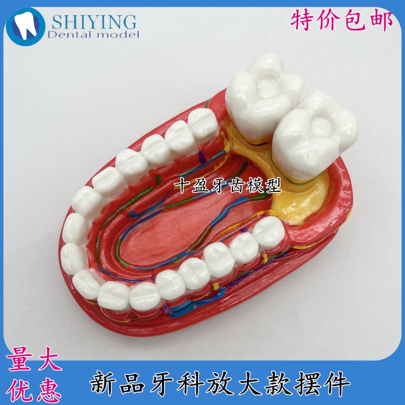 牙科口腔教学模型牙科诊所摆台医患沟通展示牙神经结构大牙模型