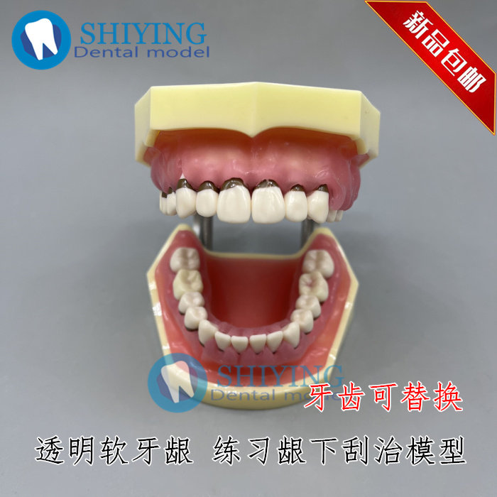 牙科 牙周病理模型 练习牙结石刮治器模型 软牙龈牙齿可替换 4023