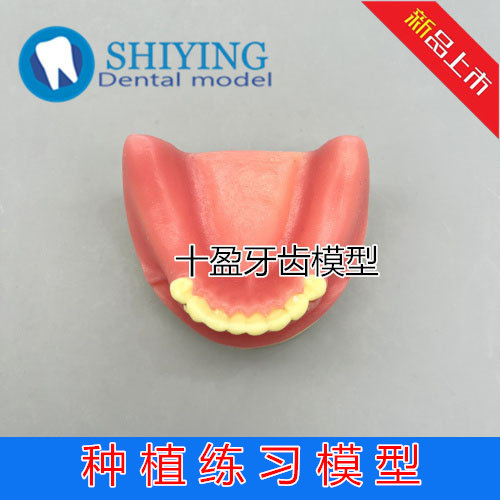 口腔种植练习模型 半口 种植模型 模具 种植体 牙科种植模型 包邮