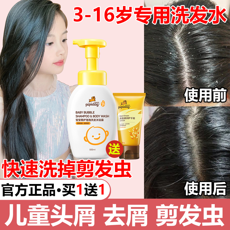 Children Shampoo Special Girl Child to Scrap Itch 8-year-old Cut Hair Worm Boy Official Flagship Store