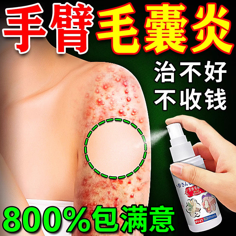 Folliculitis on the Arm, Pimples on the Arm, Special Imported Medicine for Removing Keratosis Pilaris, Hair Follicle Keratosis Antibacterial Spray