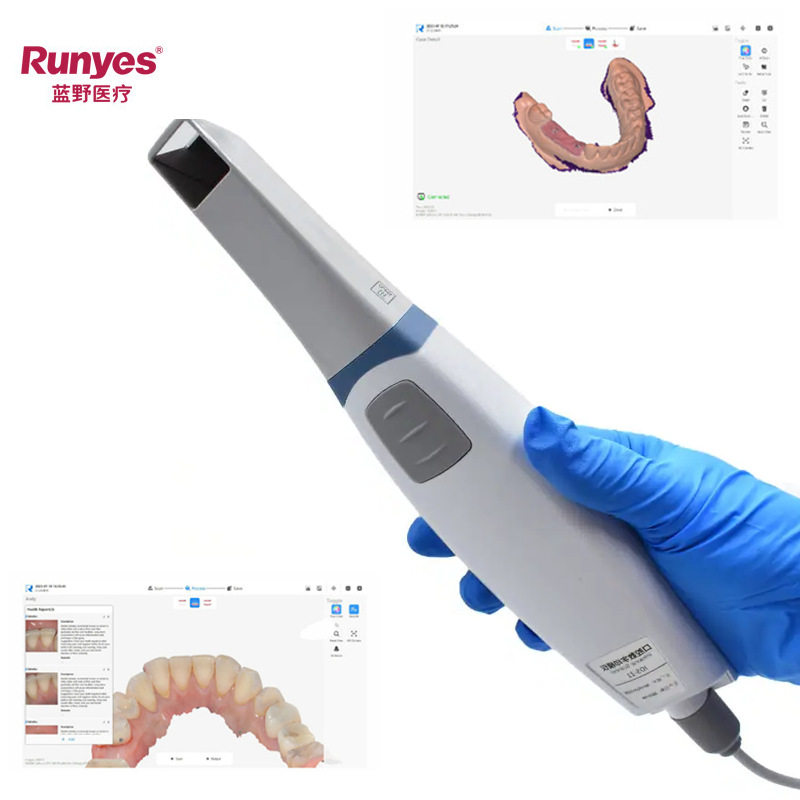 Runyes蓝野3D口扫仪:告别传统牙模,数字化口腔新革命!-口腔护理配件-淘宝好物网
