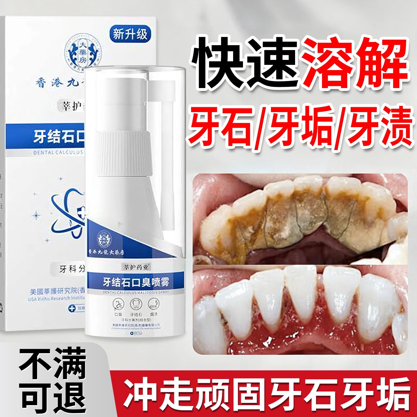 歯石除去剤、歯をきれいにし、着色汚れや口臭を取り除き、歯垢を素早く溶かす強力で効果的な歯の着色汚れ除去スプレー。