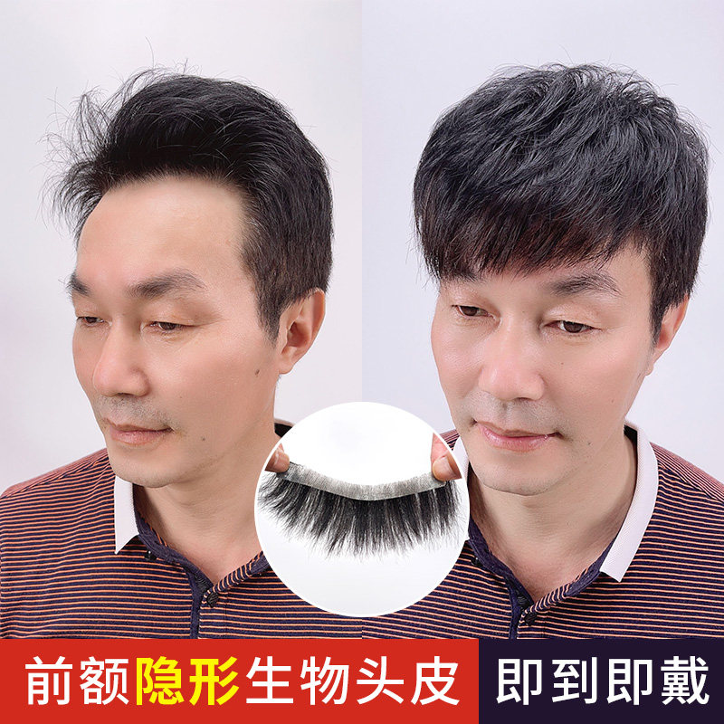 Hair-line wig stickup men's invisible biological scalp v type True hair Hair Tonic sheet Men's fine Forehead Wig sheet-Taobao