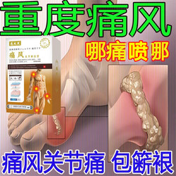 Xitong Pills for rheumatoid arthritis, deformed, ໃຄ່ບວມແລະເຈັບຂອງນິ້ວມື, ສະບັບໃຫມ່ຂອງຢາປົວພະຍາດ gout ພິເສດເພື່ອບັນເທົາອາການເຈັບປວດແລະລົບ rheumatism