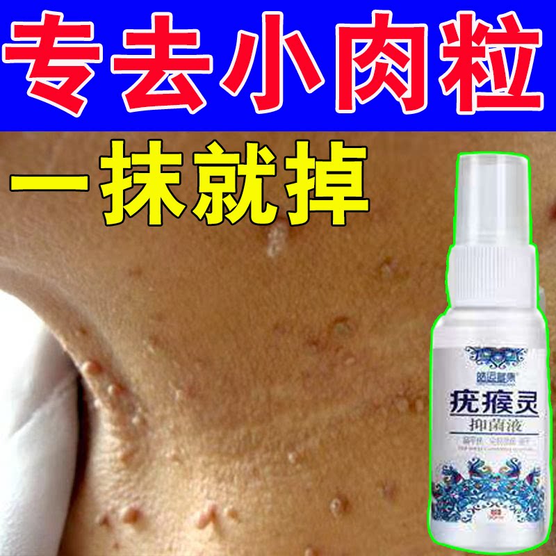 Go to the monkey's granular pill to remove the hedgehog to remove the artifacts from the anaphylaxis