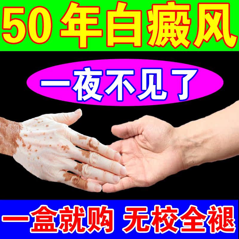 External medicine for vitiligo
